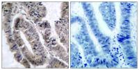 AMPKα1 (phospho Ser496) Polyclonal Antibody