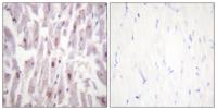 TRAP220 (phospho Thr1457) Polyclonal Antibody