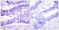 WAVE1 (phospho Tyr125) Polyclonal Antibody