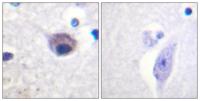 Vav2 (phospho Tyr142) Polyclonal Antibody