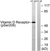 VDR (phospho Ser208) Polyclonal Antibody