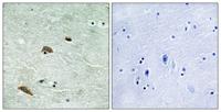 TTK (phospho Thr676) Polyclonal Antibody