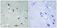 Akt1/3 (phospho Tyr437/434) Polyclonal Antibody