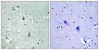 Raf-B (phospho Ser446) Polyclonal Antibody