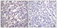 Raf-B (phospho Ser602) Polyclonal Antibody