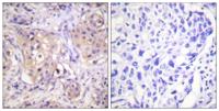 PKC (phospho Thr497) Polyclonal Antibody
