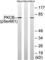 PKC β (phospho Ser661) Polyclonal Antibody