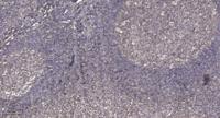 PKC β (phospho Ser661) Polyclonal Antibody