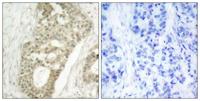PKC δ (phospho Ser645) Polyclonal Antibody