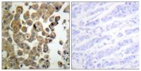 PKC δ (phospho Thr507) Polyclonal Antibody