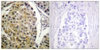 PKC δ (phospho Tyr313) Polyclonal Antibody