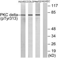 PKC δ (phospho Tyr313) Polyclonal Antibody
