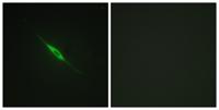 PKC δ (phospho Tyr52) Polyclonal Antibody