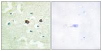 PTP1B (phospho Ser50) Polyclonal Antibody