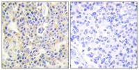 PKC θ (phospho Ser695) Polyclonal Antibody