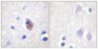 PYK2 (phospho Tyr881) Polyclonal Antibody