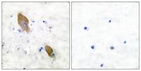 PYK2 (phospho Tyr881) Polyclonal Antibody