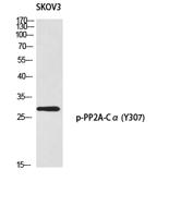 PP2A-Cα (phospho Tyr307) Polyclonal Antibody