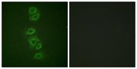 PP2A-Cα (phospho Tyr307) Polyclonal Antibody