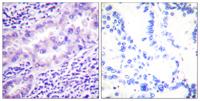 PP2A-Cα (phospho Tyr307) Polyclonal Antibody