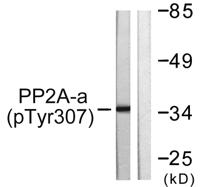 PP2A-Cα (phospho Tyr307) Polyclonal Antibody