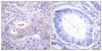 PFK-2 car (phospho Ser483) Polyclonal Antibody