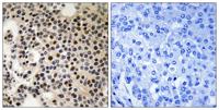 PAKγ (phospho Ser197) Polyclonal Antibody