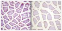 Parkin (phospho Ser131) Polyclonal Antibody