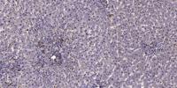 p70 S6 kinase α phospho Ser434 Polyclonal Antibody