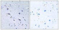 p70 S6 kinase α (phospho Thr229) Polyclonal Antibody