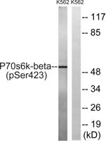 p70 S6 kinase β (phospho Ser423) Polyclonal Antibody