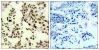 p73 (phospho Tyr99) Polyclonal Antibody