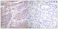 Gab 1 (phospho Tyr659) Polyclonal Antibody