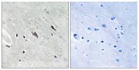 Gab 2 (phospho Tyr643) Polyclonal Antibody