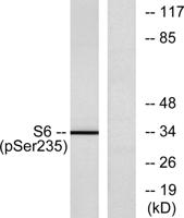Ribosomal Protein S6 (phospho Ser235) Polyclonal Antibody