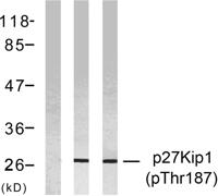 p27 (phospho Thr187) Polyclonal Antibody