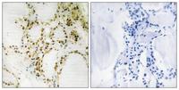 p300 (phospho Ser89) Polyclonal Antibody