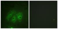 p47-phox (phospho Ser359) Polyclonal Antibody