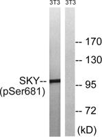 MerTK/Tyro3 (phospho Tyr749/681) Polyclonal Antibody