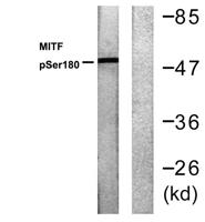 MITF (phospho Ser180) Polyclonal Antibody