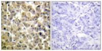 MSK1 (phospho Ser360) Polyclonal Antibody