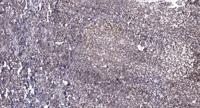 MSK1 (phospho Thr581) Polyclonal Antibody