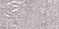 MYLK (phospho Tyr464) Polyclonal Antibody