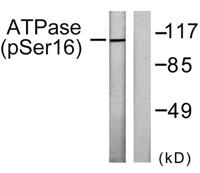 Na+/K+-ATPase α1 (phospho Ser16) Polyclonal Antibody