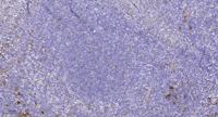 NCAM-L1 (phospho Ser1181) Polyclonal Antibody