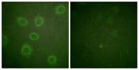 HER2 (phospho Thr686) Polyclonal Antibody