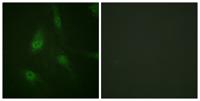 NFATc3 (phospho Ser165) Polyclonal Antibody