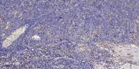NFATc4 (phospho Ser676) Polyclonal Antibody
