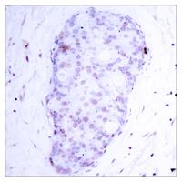 NFκB-p105 (phospho Ser907) Polyclonal Antibody