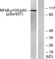 NFκB-p105 (phospho Ser907) Polyclonal Antibody
